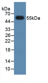 Active Dickkopf Related Protein 1 (DKK1)