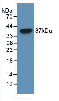 Active Pregnancy Associated Plasma Protein A (PAPPA)