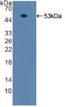 Active Death receptor 5 (DR5)