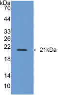 Active Nitric Oxide Synthase 2, Inducible (NOS2)