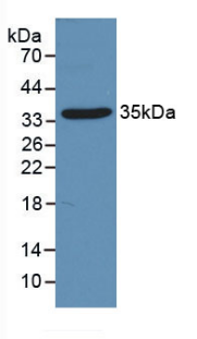 Active Receptor Activator Of Nuclear Factor Kappa B Ligand (RANkL)