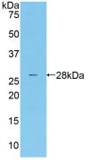 Active Mannose Associated Serine Protease 2 (MASP2)