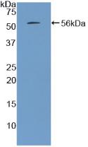 Active Parathyroid Hormone (PTH)