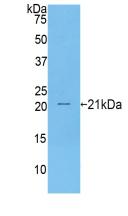 Active Tumor Necrosis Factor Receptor Superfamily, Member 7 (TNFRSF7)