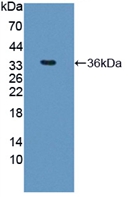 Active Arginase (ARG)