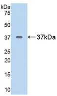 Active Arginase (ARG)