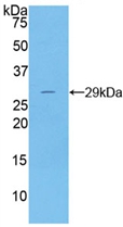 Active Deoxyribonuclease I (DNASE1)