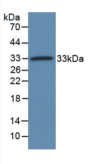 Active Taxilin Alpha (TXLNa)