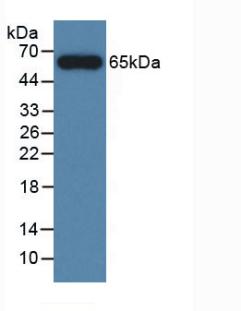 Active V-Myc Myelocytomatosis Viral Oncogene Homolog (MYC)