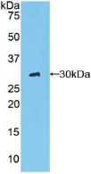 Active Chymotrypsin C (CTRC)