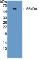 Active Ornithine Decarboxylase (ODC)