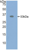 Active Vascular Endothelial Growth Factor Receptor 2 (VEGFR2)