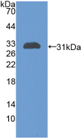 Active Chitinase-3-like Protein 1 (CHI3L1)