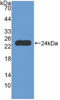 Active Tumor Necrosis Factor Receptor 1 (TNFR1)