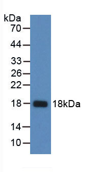 Active Secondary Lymphoid Tissue Chemokine (SLC)