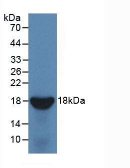 Active Interleukin 10 Receptor Beta (IL10Rb)