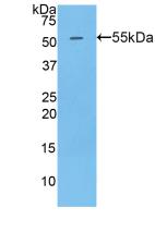 Active Golgi Phosphoprotein 2 (GOLPH2)