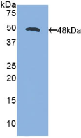 Active Interleukin 21 (IL21)