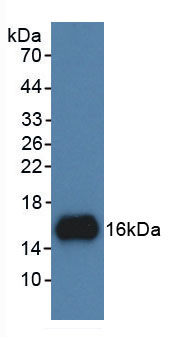 Active UDP Glucose Ceramide Glucosyltransferase (UGCG)