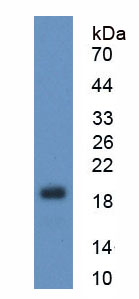 Active Signal Transducer And Activator Of Transcription 3 (STAT3)