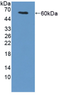 Active Transglutaminase 1 (TGM1)