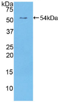 Active Receptor Tyrosine Protein Kinase erbB-2 (ErbB2)