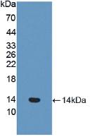 Active Coagulation Factor VII (F7)