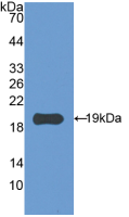 Active Annexin A2 (ANXA2)