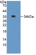 Active Hepcidin (Hepc)