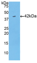 Active Creatine Kinase B (CK-BB)