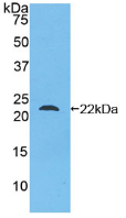 Active Mesencephalic Astrocyte Derived Neurotrophic Factor (MANF)