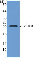 Active Adenine Phosphoribosyltransferase (APRT)