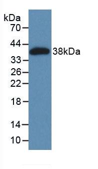 Active Microfibrillar Associated Protein 2 (MFAP2)