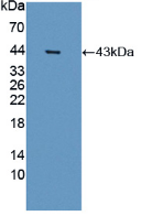 Active Paraoxonase 2 (PON2)