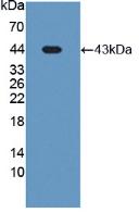 Active Paraoxonase 3 (PON3)