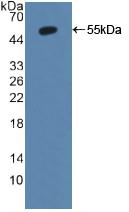 Active Cytochrome P450 1A2 (CYP1A2)