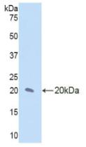 Active Interleukin 17 Receptor D (IL17RD)