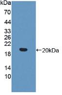 Active Interleukin 17 Receptor B (IL17RB)