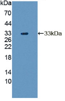 Active Tyrosine Aminotransferase (TAT)