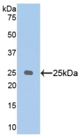 Active Puromycin Sensitive Aminopeptidase (PSA)