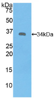 Active Spleen Tyrosine Kinase (SYK)