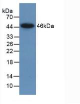 Active Lemur Tyrosine Kinase 3 (LMTK3)