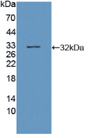 Active Sirtuin 3 (SIRT3)