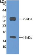 Active Sirtuin 3 (SIRT3)