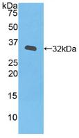 Active Janus Kinase 3 (JAK3)