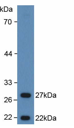 Active Cold Inducible RNA Binding Protein (CIRBP)