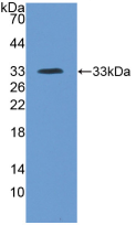 Active Inter Alpha-Globulin Inhibitor H4 (ITIH4)