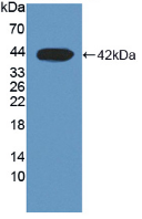 Active Dihydroorotate Dehydrogenase (DHODH)