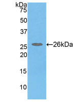 Active Catechol-O-Methyltransferase (COMT)