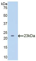 Active Lecithin Cholesterol Acyltransferase (LCAT)